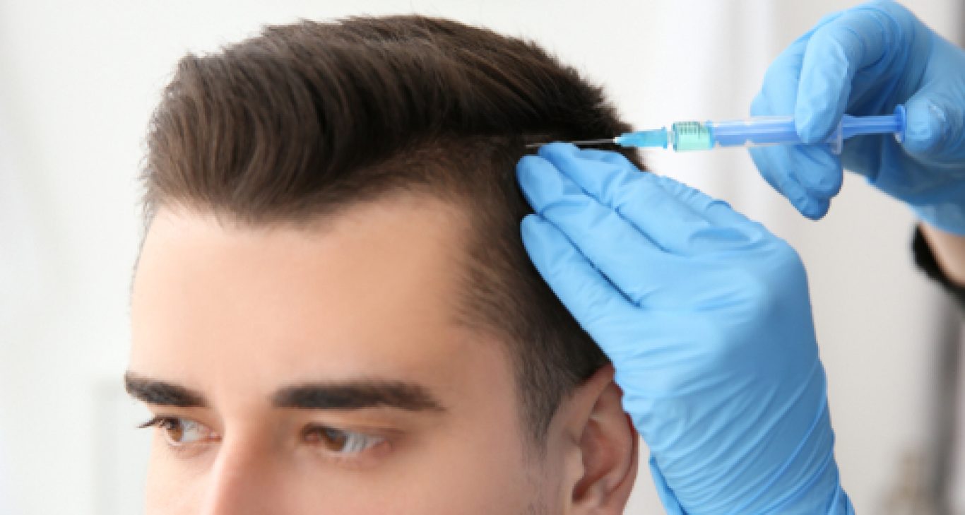 How To Get Long Lasting Results From Hair Transplantation?
