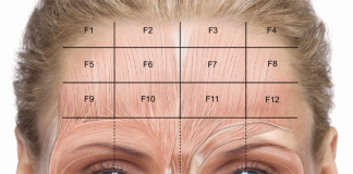 Botox Injection Techniques Forehead Enfield Royal clinic in Dubai